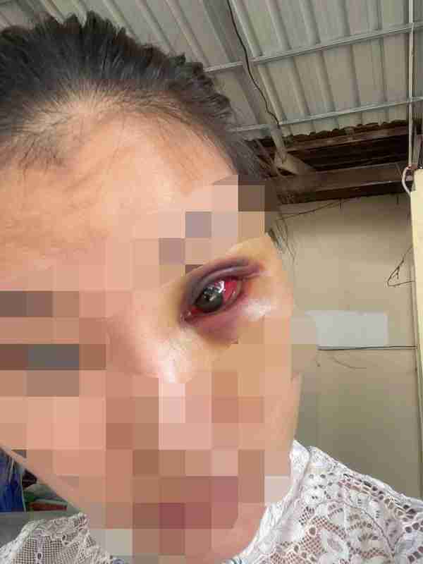 90后福建女子柬埔寨遭性侵殴打，装顺从逃出报警，女子至今被威胁“不翻供就报复”